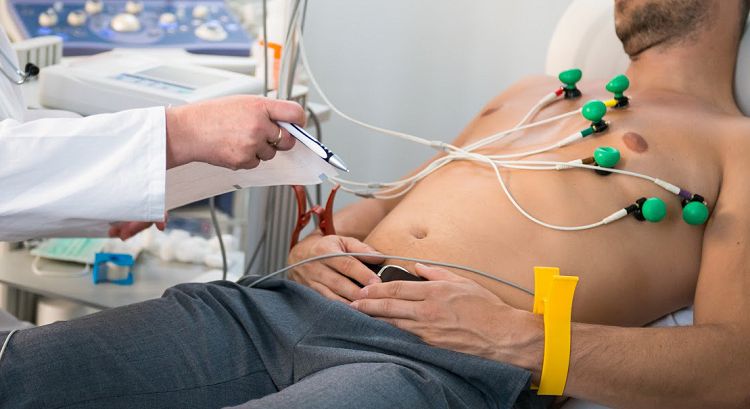 ECG điện tim điện tâm đồ