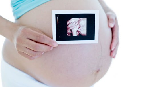 Phù nhau thai là gì? Có nguy hiểm không?