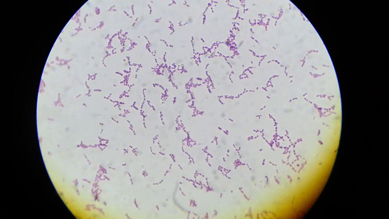 Vi khuẩn Streptococcus agalactae gây viêm phổi ở trẻ sơ sinh