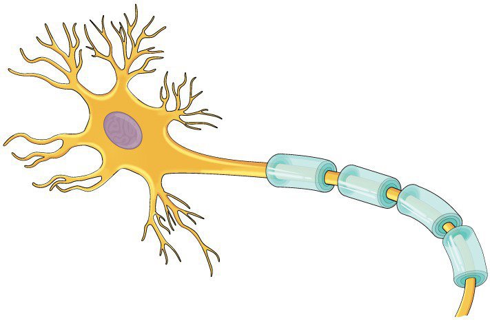 Viêm đa dây thần kinh hủy Myelin là loại bệnh thần kinh phổ biến
