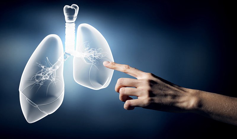 viêm phổi không điển hình