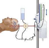 Đặt Catheter vào nhu mô đo áp lực nội sọ