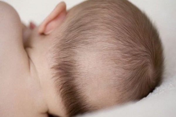 Trẻ 3 tháng bị ra nhiều mồ hôi kèm rụng tóc có phải do thiếu vitamin D?
