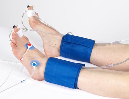 Tìm hiểu chỉ số huyết áp cổ chân - cánh tay ( ABI )