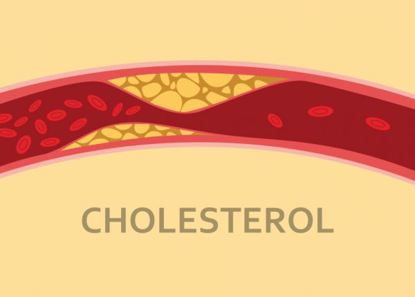 nồng độ cholesterol.