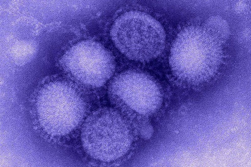 Virus cúm A(H1N1)