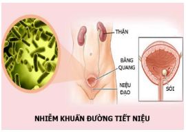 Nhiễm khuẩn đường tiết niệu