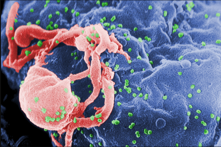 Hình ảnh HIV-1 (xanh lục) quét từ kính hiển vi điện tử.