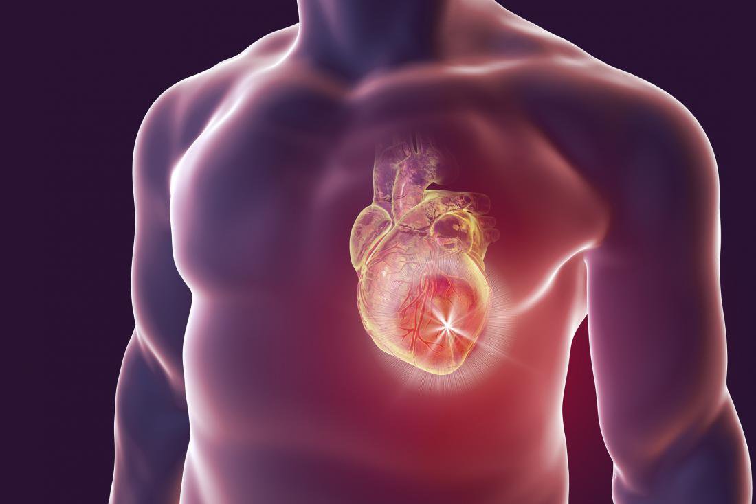 Hội chứng tim mạch chuyển hóa