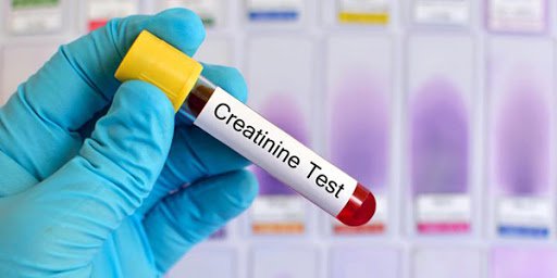 xét nghiệm creatinin
