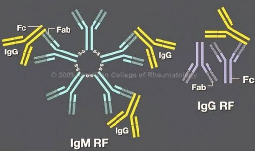 Xét nghiệm yếu tố dạng thấp (RF)