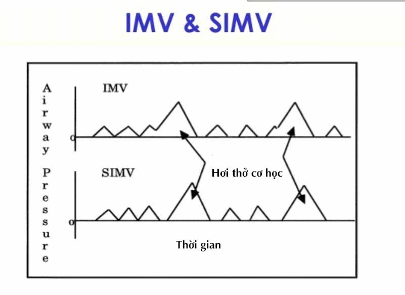 IMV/SIMV