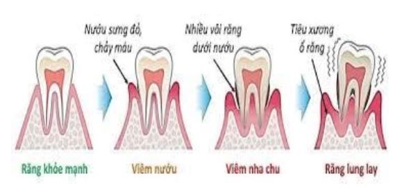 Bệnh lý về răng