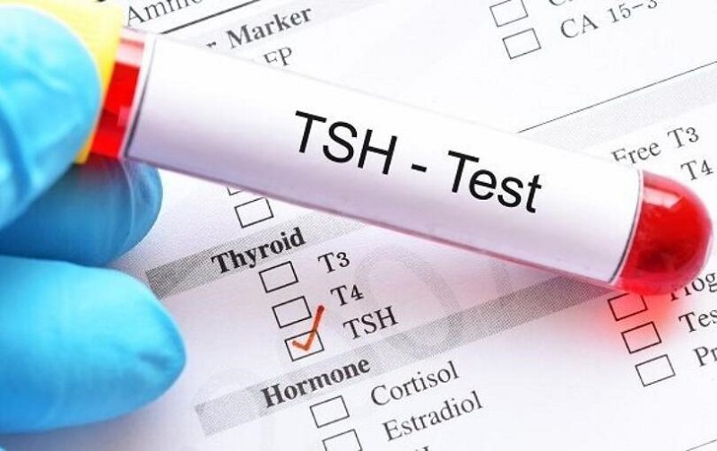 Xét nghiệm nồng độ hormone TSH giúp chẩn đoán bệnh hiệu quả