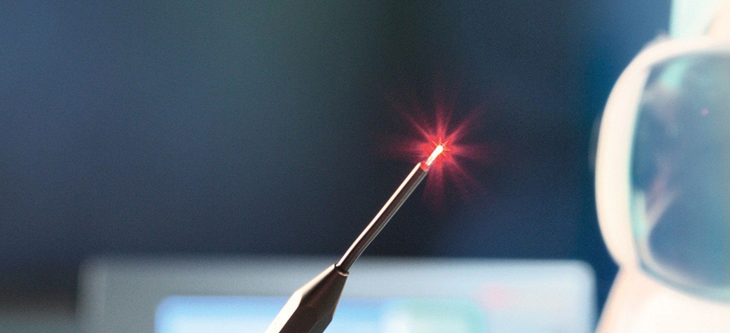Phương pháp laser nội mạch đang rất phổ biến trên thế giới