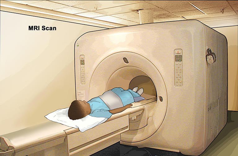 MRI trẻ nhỏ