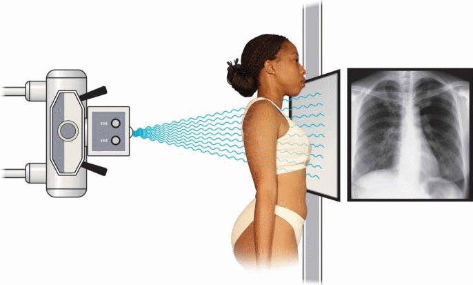 Nguyên lý chụp phim X-quang