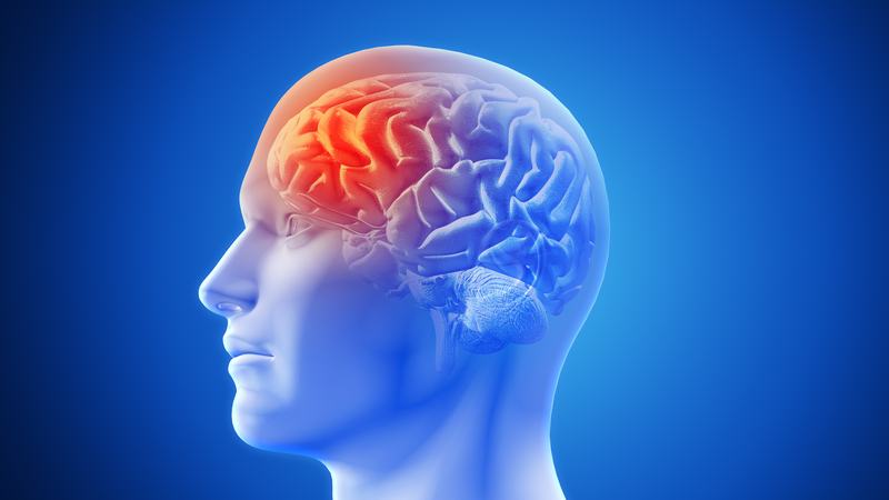 Chụp cộng hưởng từ chức năng giúp đánh giá chức năng não sau đột quỵ