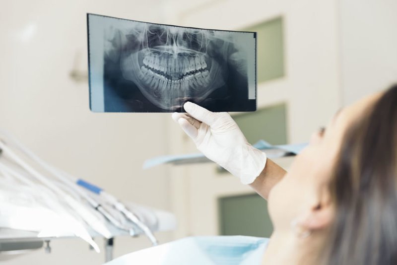 Chụp X-quang răng giúp ghi rõ lại những hình ảnh trong khoang miệng