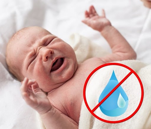 Trẻ bị mất nước là nguyên nhân gây sốc giảm thể tích tuần hoàn