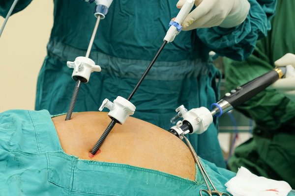 Phẫu thuật nội soi là phương pháp xử lý thai ngoài tử cung phổ biến