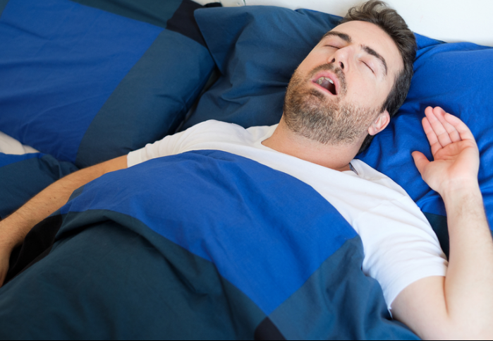 Hội chứng ngưng thở khi ngủ