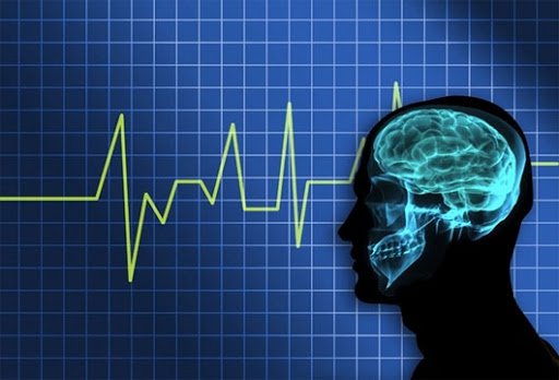 Điện não đồ giúp chẩn đoán chết não