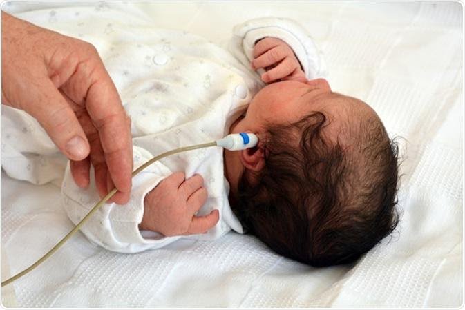 Điều dưỡng đo âm ốc tai cho bé sơ sinh t