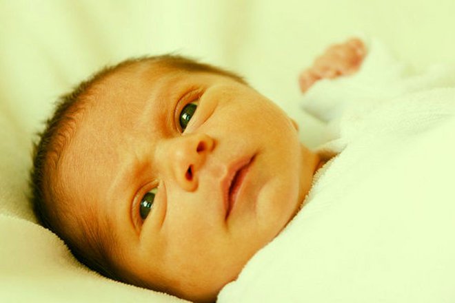 Dấu hiệu nhận biết vàng da ở trẻ sơ sinh