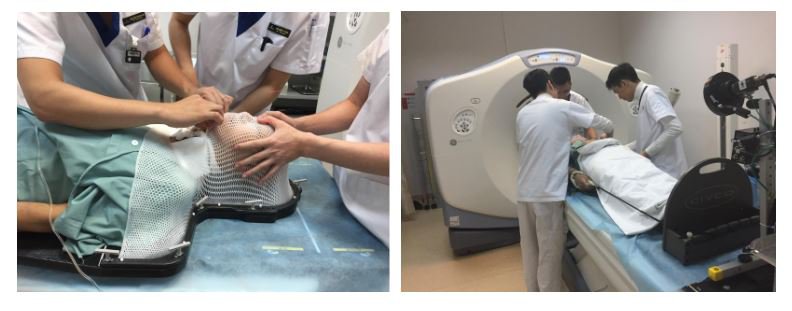Làm mặt nạ, đặt tư thế và cố định bệnh nhân trong phòng chụp CT mô phỏng.