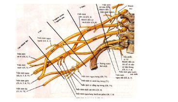 Giải phẫu đám rối thần kinh cánh tay