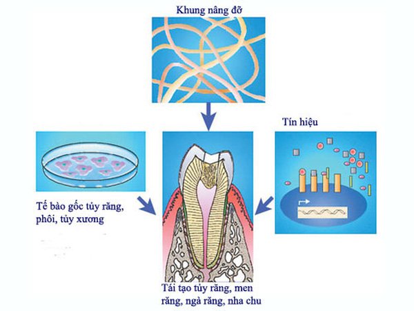 tế bào gốc tủy răng sữa trong y học tái tạo