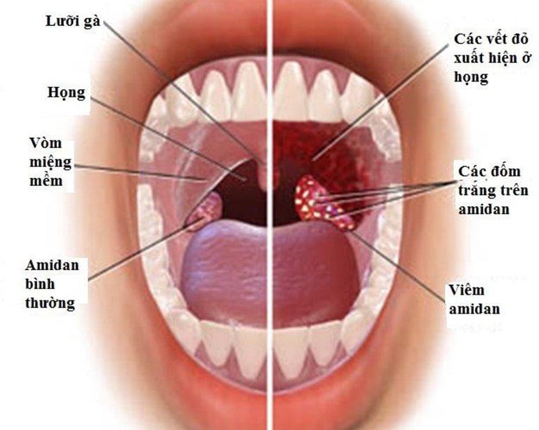 Giải phẫu cổ họng