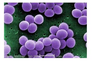 Tụ cầu vàng (Staphylococcus aureus)
