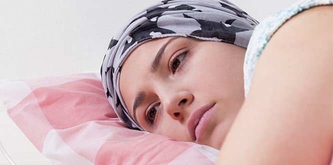 Sau xạ trị ung thư vú bệnh nhân thường bị buồn ngủ