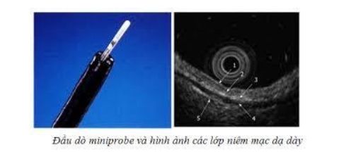 Hình ảnh một đầu dò siêu âm được đưa qua kênh thủ thuật của ống soi và hình ảnh nội soi siêu âm
