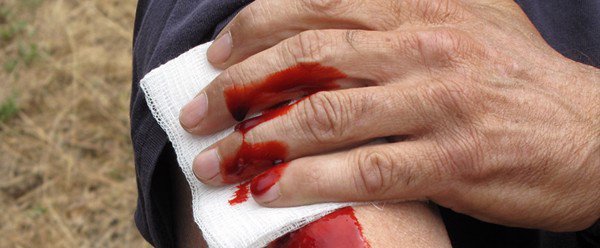 Vết thương chảy máu nghiêm trọng do động vật cắn cần đưa người bệnh đến bệnh viên ngay