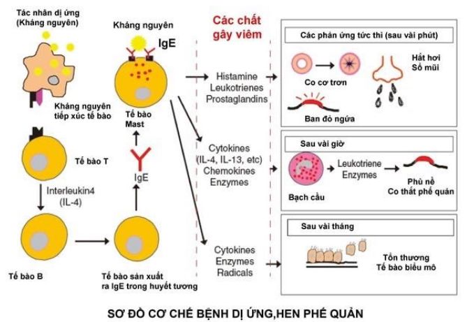 Sơ đồ cơ chế bệnh dị ứng, hen phế quản