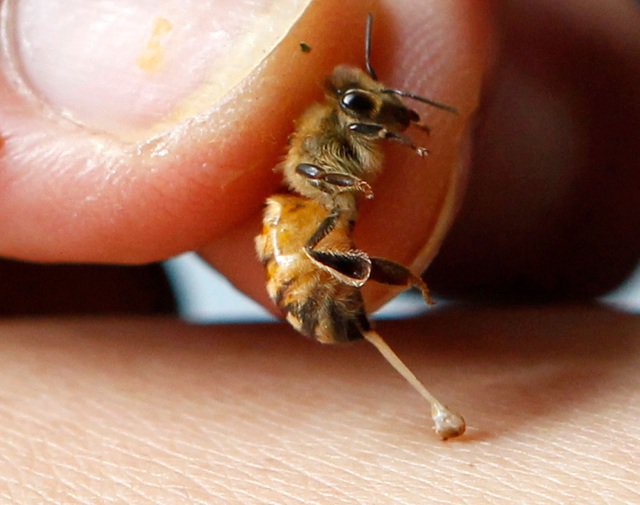 nọc độc của ong