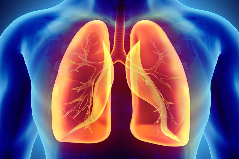 Tràn dịch màng phổi có nguy cơ bị ung thư
