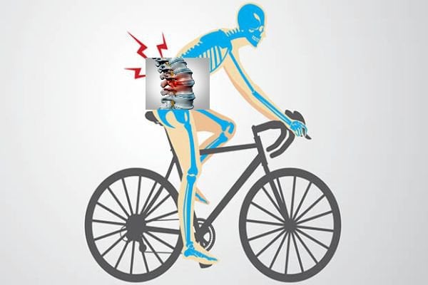 Đau thắt lưng có nên đi xe đạp
