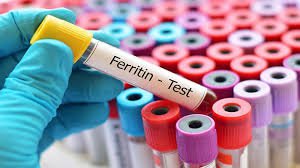 Xét nghiệm máu có chỉ số Ferritin > 2000 ng/dl có sao không?