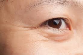 Làm thế nào để giúp vùng da dưới mắt săn chắc hơn?