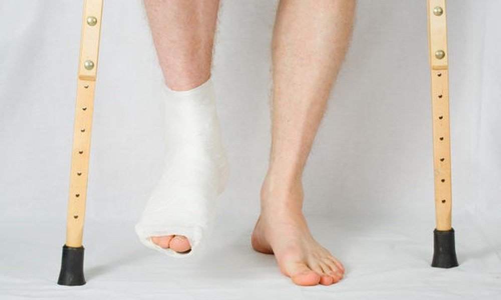 Gãy hở cổ chân đã điều trị hai tuần nhưng vết thương vẫn còn nước có nguy hiểm không?