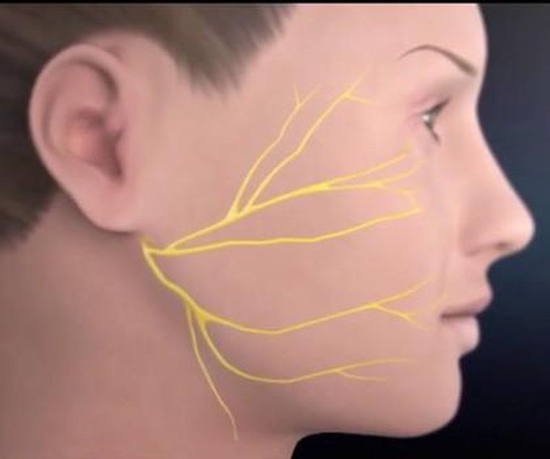 Bị giật, buốt nhói vùng hàm mặt, thái dương bên trái mặt biểu hiện bệnh gì có tự điều trị được không?