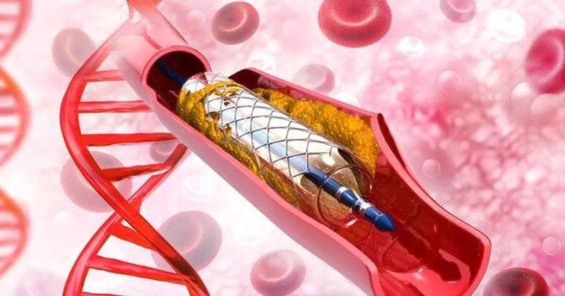 Đặt stent động mạch vành loại phủ thuốc có an toàn hơn các loại stent khác?