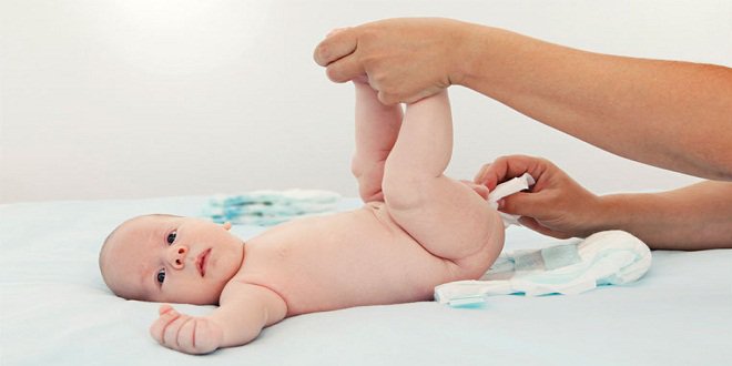Trẻ sơ sinh bị viêm ruột kèm phân có dịch nhầy, trắng là triệu chứng bệnh gì?