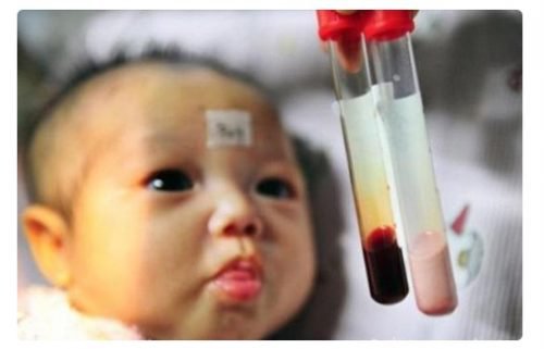 Sàng lọc thiếu máu huyết tán ở trẻ dưới 6 tháng tuổi có chính xác không?