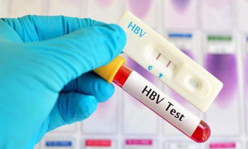 Kết quả xét nghiệm HBV 1,85 x 10^ 3 IU/mL đang ở mức nào?