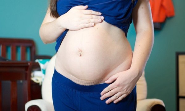 Có thai sau sinh mổ 9 tháng có ảnh hưởng đến vết mổ không?